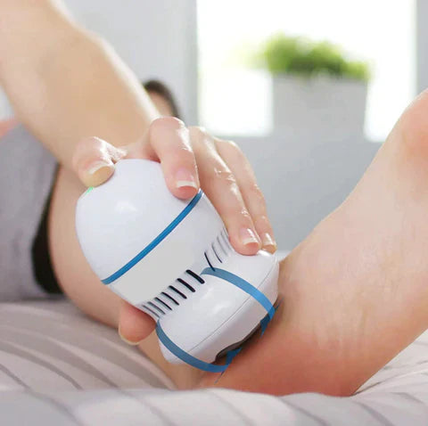 RadiVita) Vacuum Callus Remover