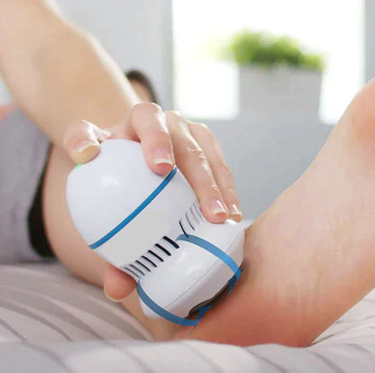 RadiVita) Vacuum Callus Remover